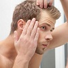 توضیحاتی در مورد ریزش مو بعد از کاشت مو